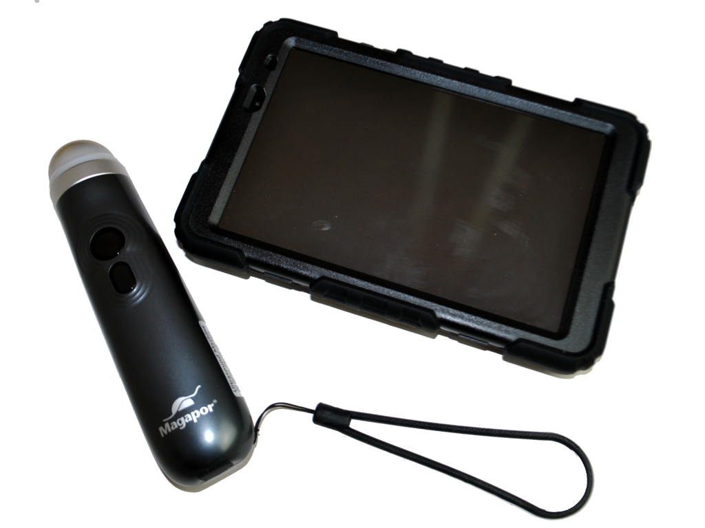 Ultralydsscanner, magascan