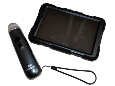 Ultralydsscanner, magascan